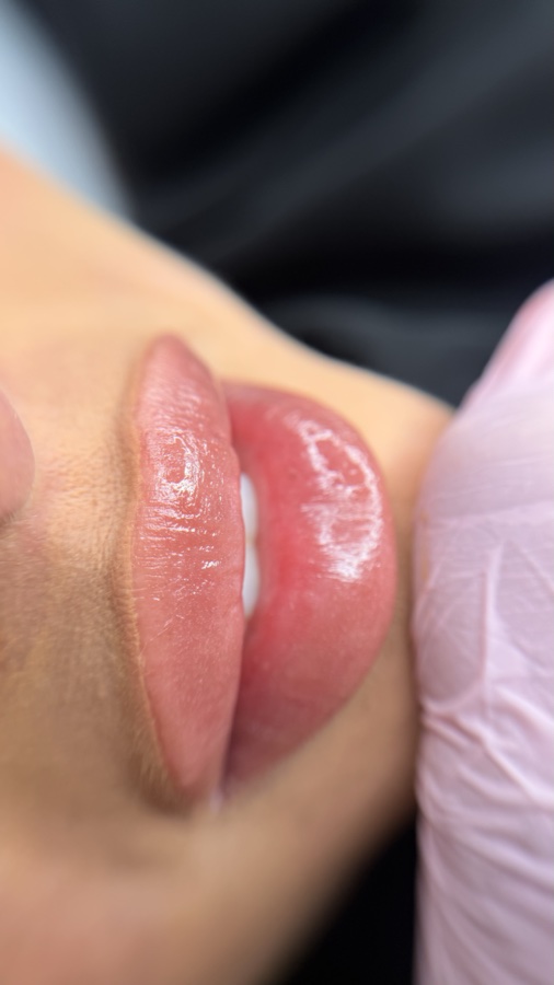 Labial — resultado final